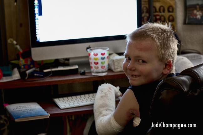 Nicky at his computer, photo courtesy of Jodi Champagne, from the book 'Courage Under Wraps'