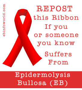 EB Awareness Tags by Silvia Pt 2 | EB Info World